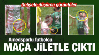 Amedsporlu futbolcu maça jiletle çıktı!